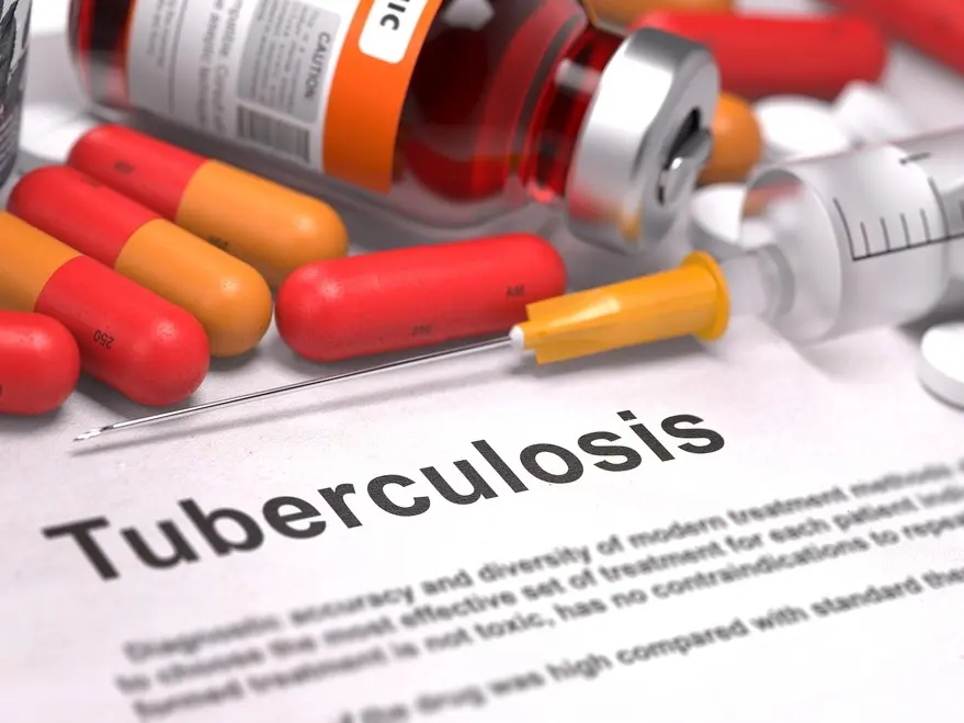 Health Officials Confirm Active TB Case In Branch County